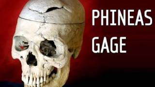 Phineas Gage A Song  YouTube Music [upl. by Aehsel812]