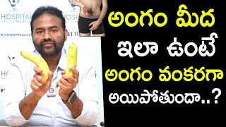 Curved Penis  Myths And Facts  Peyronies Disease Treatment  Dr Ashish Reddy  Andro9 [upl. by Aihceyt797]