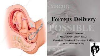 Teaching Forceps Delivery [upl. by Behre]