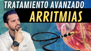 MIRA¡ Asi es un Estudio ELECTROFISIOLÓGICO y ABLACIÓN en arritmias 💥 [upl. by Anitnelav618]