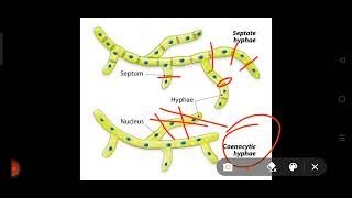 Septate hyphaeCoenocytic hyphaeneetbiologylifesxienceneet [upl. by Nedah858]