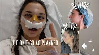 I got a nose job in secret and vlogged the process [upl. by Ahsena]