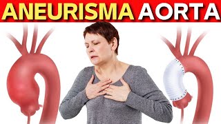 Aneurisma de Aorta Causas Riesgos Como evitar los Aneurismas [upl. by Yeslrahc]