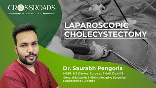 Dr Saurabh Pengoria The Best in Laparoscopic Cholecystectomy  CrossroadsHospitalofficial [upl. by Aivatan]