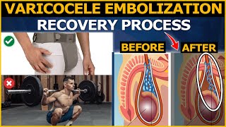 Varicocele Treatment  Your Complete Guide to Varicocele Embolization Recovery Process [upl. by Brote785]