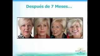 ¿Cómo rejuvenecer hasta 15 años en 90 días sin botox ni cirugía ComoRejuvenecer MásJovenEn15Min [upl. by Dhumma]