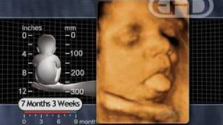 Fetus 7 12 months  Breathing Movements [upl. by Novej]