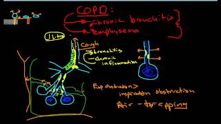 Pathophysiology of COPD [upl. by Beaulieu]