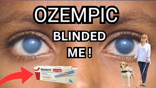 Blindness From Ozempic The New Side Effect  Dr Messina Explains NAION [upl. by Avert]