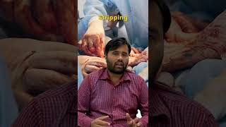 Best Surgical Treatments for Varicose Veins  Surat Diabetic Foot amp Ulcer Clinic [upl. by Kast]