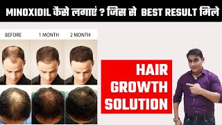 How to use Minoxidil for hair regrowth  Effective hair regrowth solution with 100 result [upl. by Ordnaxela]