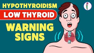 Signs that you have a Low Thyroid Level  Hypothyroidism  Signs amp Symptoms  Thyroid disease [upl. by Aeuhsoj]