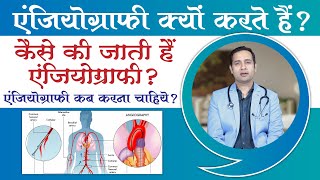 एंजियोग्राफी क्या होती है और कैसे करते हैं  Angiography in Hindi  Dr Jagjeet Deshmukh  Sahyadri [upl. by Reltuc957]