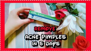 Fusil B cream review Remove Acne Pimples in 5 days  by Adan Expert 😊 [upl. by Munniks]