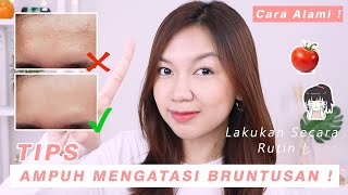 Cara Mengatasi Bruntusan Secara Alami ala Desty  Desty Yufenti [upl. by Hajed21]