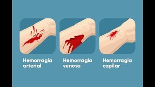 Primeiros Socorros  O que fazer em caso de hemorragia [upl. by Perusse8]