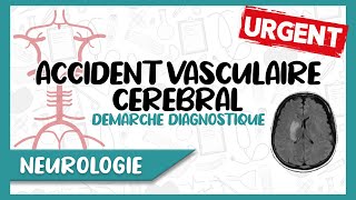 Accident Vasculaire Cérébral  Facteurs de Risque Diagnostic Clinique amp Paraclinique [upl. by Niwdla]