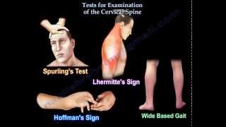 Tests For Examination Of The Cervical Spine  Everything You Need To Know  Dr Nabil Ebraheim [upl. by Spearman]