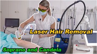 Laser Hair Removal Using Candela Gentlemax Pro [upl. by Tingley]