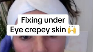 How to Fix under Eye Crepey Skin 🤩 [upl. by Ailemor]