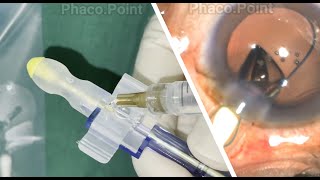 Step by Step guide to implanting the indigenous preloaded 3 piece IOL with a push type injector [upl. by Santos]