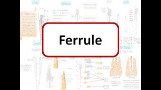 Ferrule effect Need for Ferrule Advantages Design amp Classification of Ferrule [upl. by Yeneffit566]