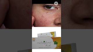 Melaglow Rich Cream Review In Hindi viralvideo ytshorts scars shorts youtubeshorts tips [upl. by Enyamrahs]