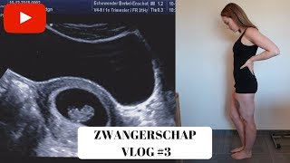 EERSTE ECHO amp MISSELIJK  6 7 amp 8 weken  ZWANGERSCHAP VLOG 3 [upl. by Dnama]