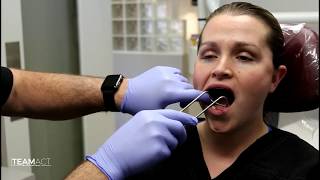 Clinical Demonstration of how to take Intra Oral Dental Photos TEAM ACT [upl. by Bergh]