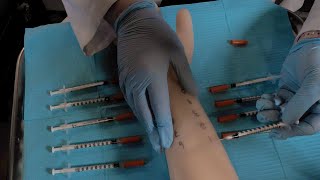 ASMR Hospital Allergy Testing  Intradermal Test Skin Exam [upl. by Aij]