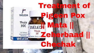 Medicine  Treatment of Pigeon Pox [upl. by Atal]