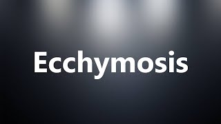 Ecchymosis  Medical Meaning and Pronunciation [upl. by Oner]