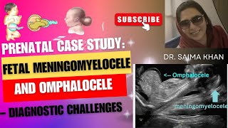 Prenatal Case Study Fetal Meningomyelocele and Omphalocele – Diagnostic Challenges DrSaimakhan [upl. by Herahab]