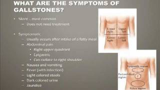 Diseases of the Gallbladder [upl. by Mikihisa]