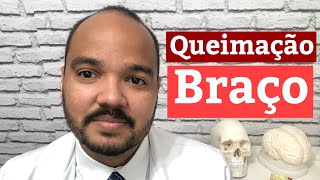 QUEIMAÇÃO NO BRAÇO E NA MÃO  Causas mais comuns [upl. by Reo]