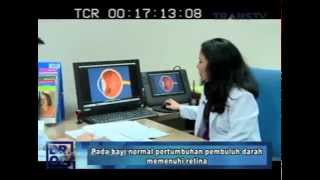 Retinopathy Of Prematurity ROP by KMN  courtesy of DrOZ TransTV [upl. by Einyaj438]