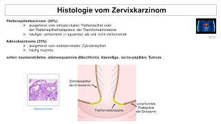 Histologie vom Zervixkarzinom  Strahlentherapie Prof Hilke Vorwerk [upl. by Agna]