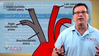 Fibrinolytic Therapy Checklist [upl. by Gabby2]