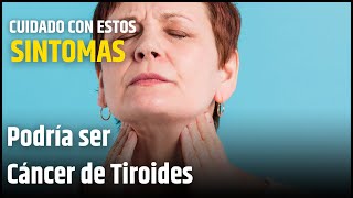 Cáncer de Tiroides cuidado con estos SINTOMAS [upl. by Camel]