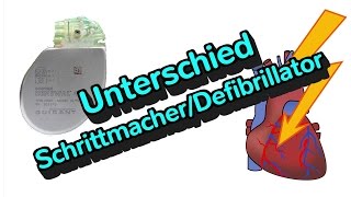 Was ist der Unterschied zwischen einem Defibrillator und einem Schrittmacher [upl. by Haibot]