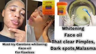 Use Carotone without side effects  How to Mix Carotone to whitening face oil for whiten dark spots [upl. by Llig313]