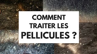 COMMENT TRAITER LES PELLICULES [upl. by Nahsab311]