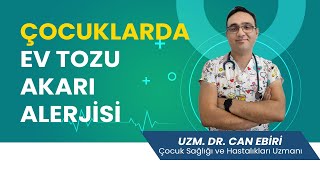 Çocuklarda Ev Tozu Akarı Alerjisi  Uzm Dr Can Ebiri [upl. by Aihsotan]