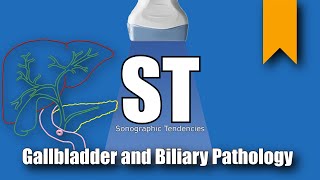 Gallbladder and Biliary Pathology [upl. by Zilla703]