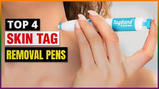 Best Skin Tag Removal Pens 2024  Top 4 Picks [upl. by Amluz]