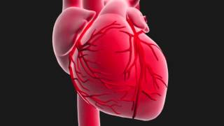 Questce quun infarctus du myocarde [upl. by Paresh]