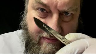 Botfly Larvae Removal ASMR [upl. by Mozes356]