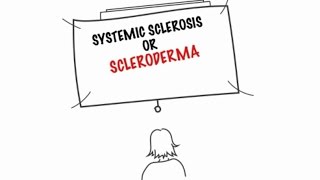 Understanding Systemic Sclerosis [upl. by Eldon]