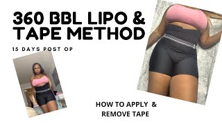 360 BBL TAPE METHOD  MASSAGE BY ARI REVIEW  BBL JOURNEY VLOG  CG COSMETICS [upl. by Ardenia]