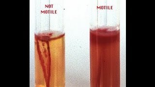 Motility Determination in Bacteria  Amrita University [upl. by Eynenihc325]